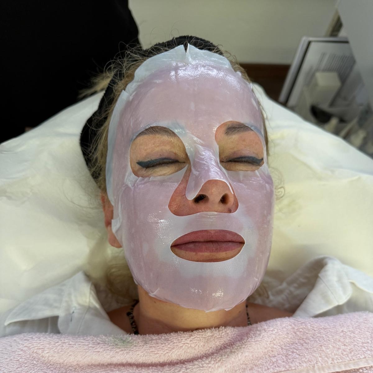 BiopeelX Behandlung 2