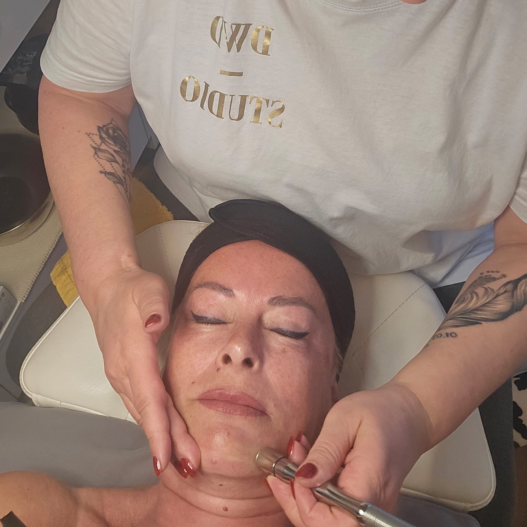 Microdermabrasion Behandlung 1