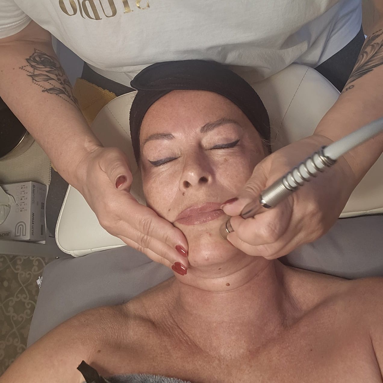 Microdermabrasion Behandlung 2