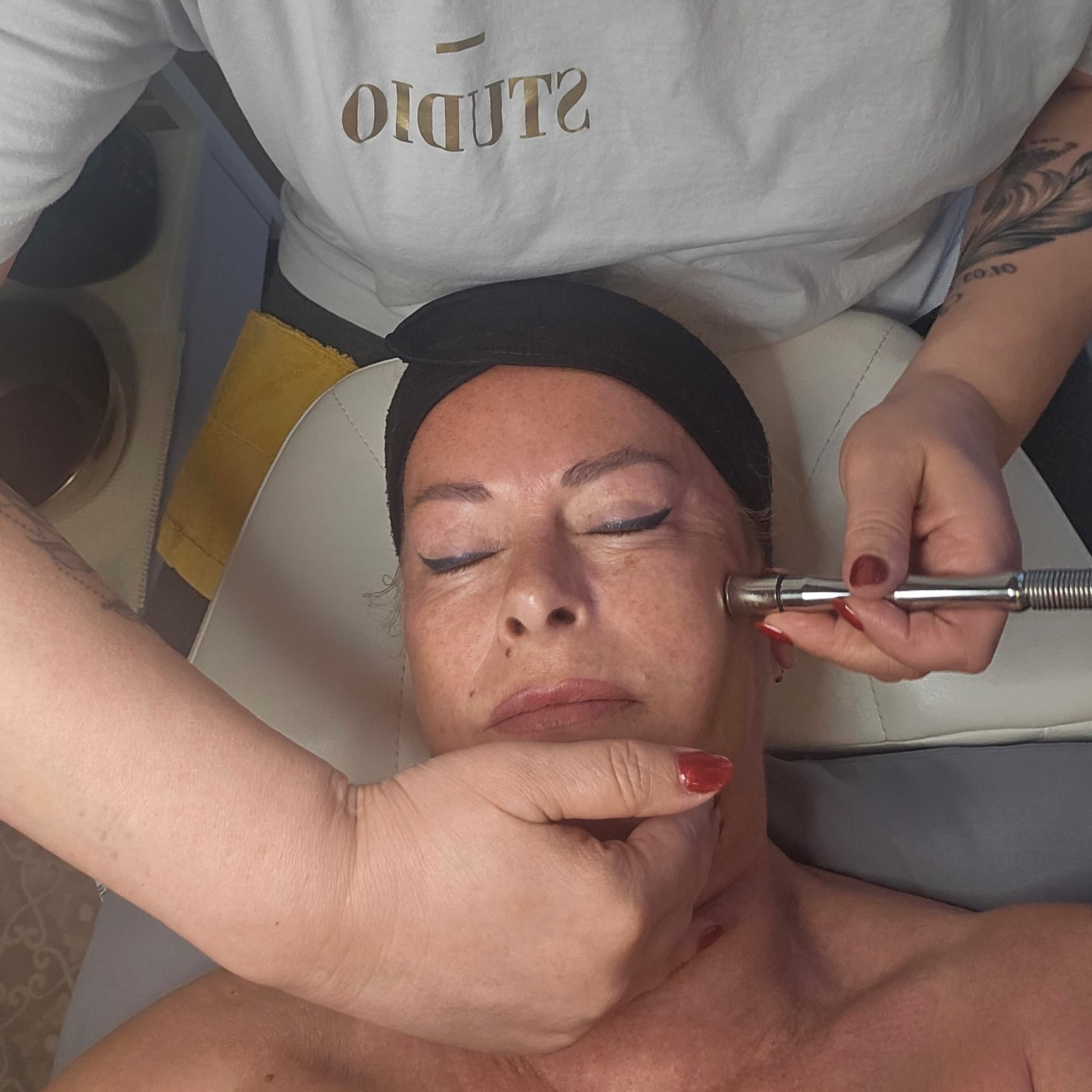 Microdermabrasion Behandlung 3